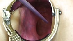 Էրիկ բոյերը